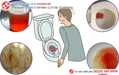 Tiểu buốt ra máu ở nam nữ do nhiều nguyên nhân gây nên