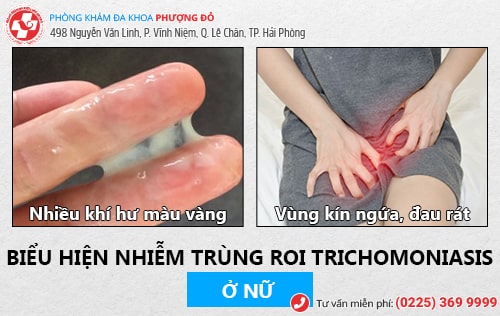 nhiễm trùng roi Trichomonas ở nữ