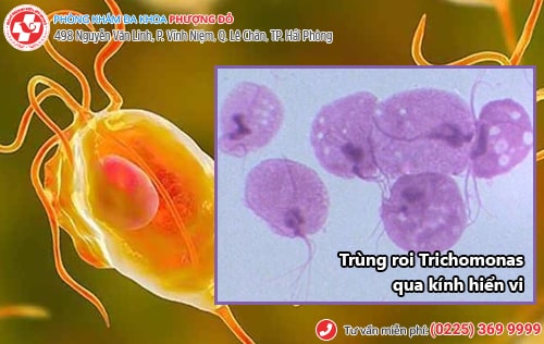 Hình ảnh trùng roi Trichomonas