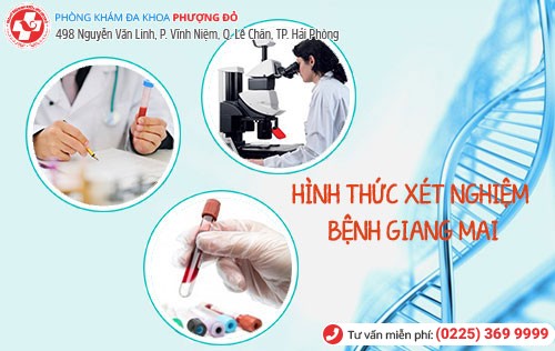 Tùy vào mức độ sẽ có phương pháp xét nghiệm giang mai tương ứng