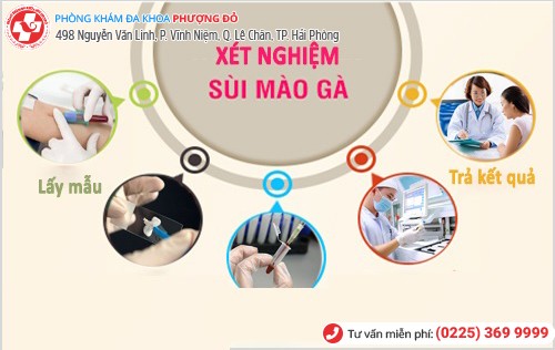 Quy trình xét nghiệm sùi mào gà khoa học cho kết quả chính xác