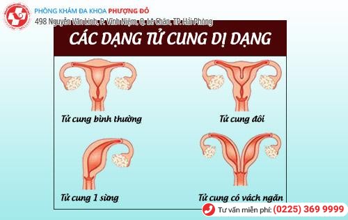 Cổ tử cung sừng hóa là gì?