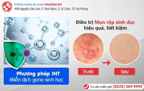 Mắc mụn rộp sinh dục vì nụ hôn của mẹ