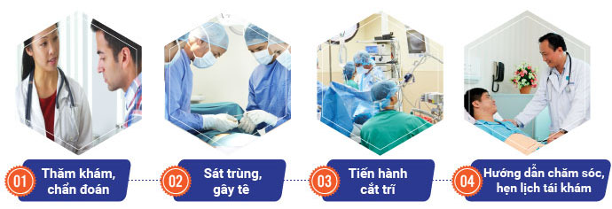 Quy trình cắt trĩ